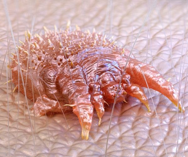 Sarcoptes,Scabiei,,Microscopic,Mite,,Causes,Scabies.,Infestation,Affects,Skin,,Leading Anti-parasitics