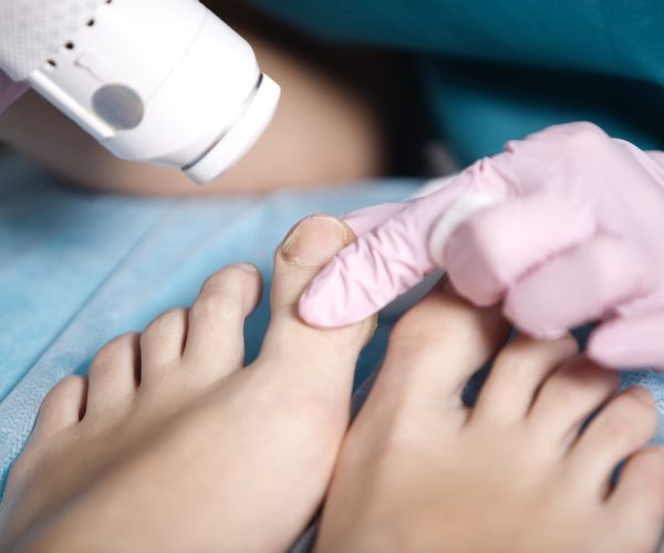 Antifungal Treatment Antifungal Treatment