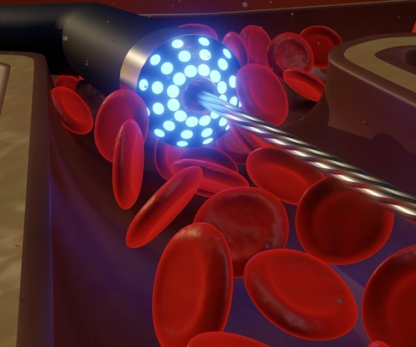 Atherectomy Atherectomy