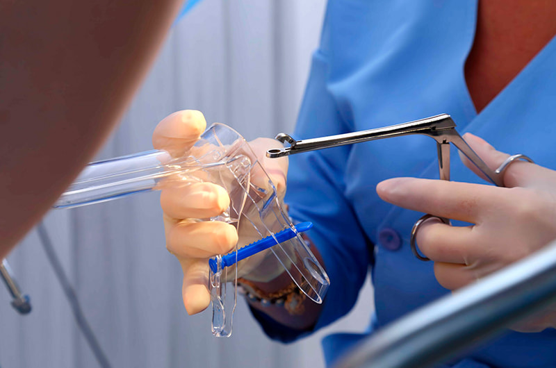 A cervical biopsy is a procedure in which a small sample of tissue is taken from the cervix—the lower part of the uterus—to examine for abnormal or precancerous cells.