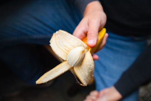 How to care for a circumcision scar to promote healing 1 Circumcision scar