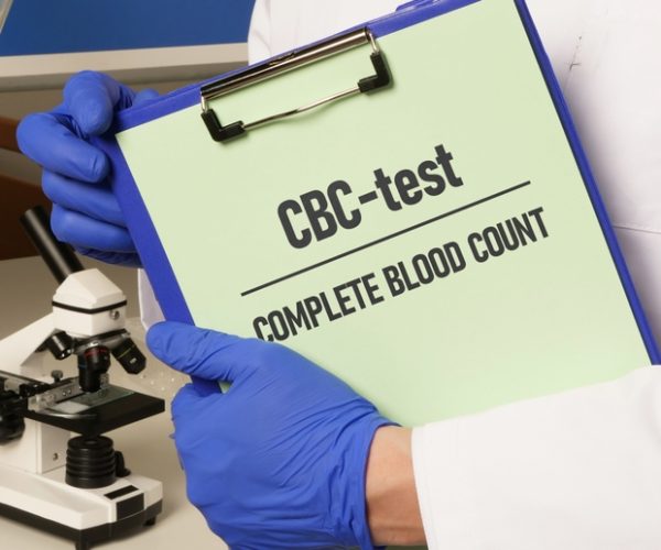 Complete Blood Count (CBC) 