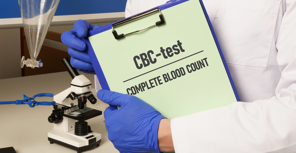 Complete blood count (cbc) 9 Complete blood count (cbc)
