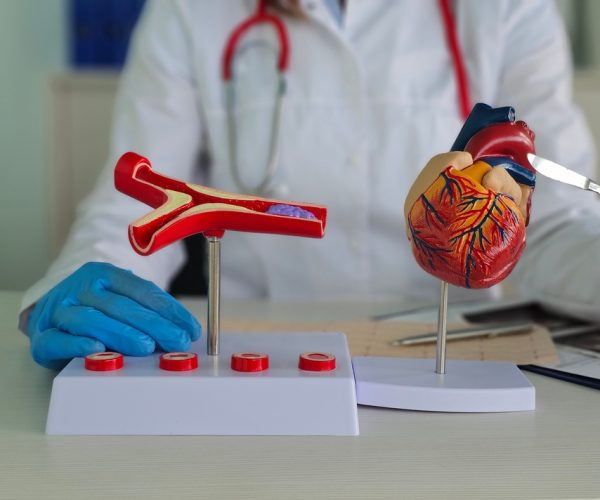 Coronary Artery Bypass Grafting (CABG)