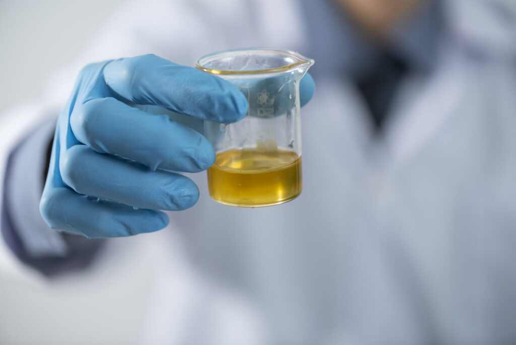 Anuria anxiety: addressing concerns and finding solutions in urology 1 Anuria symptoms