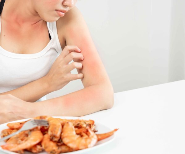 Food-Allergies Food-Allergies