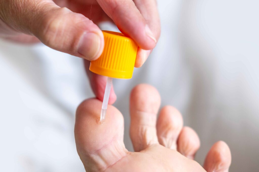 Foot lesion removal 10 Foot lesion removal