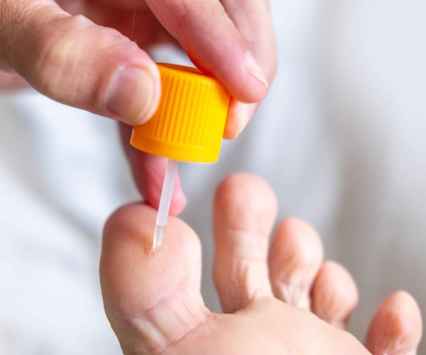 Foot Lesion Removal Foot Lesion Removal