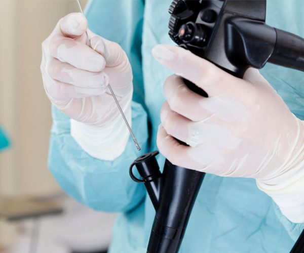 Endoscopic Ultrasound (EUS) Endoscopic Ultrasound (EUS)