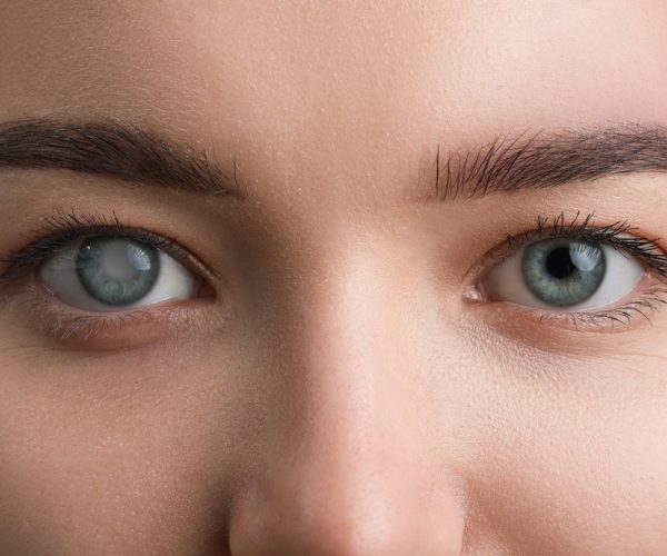 Glaucoma Surgery Glaucoma Surgery