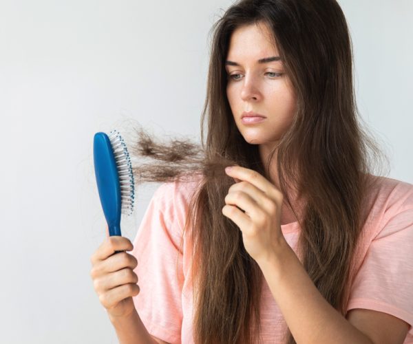 Types of Hair Loss, alopecia areata