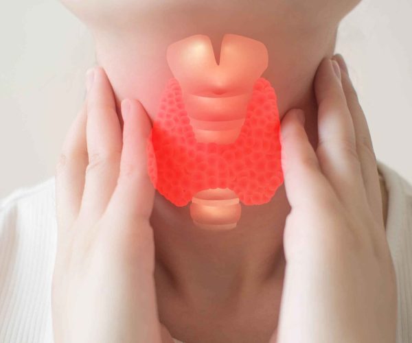 Thyroidectomy Thyroidectomy