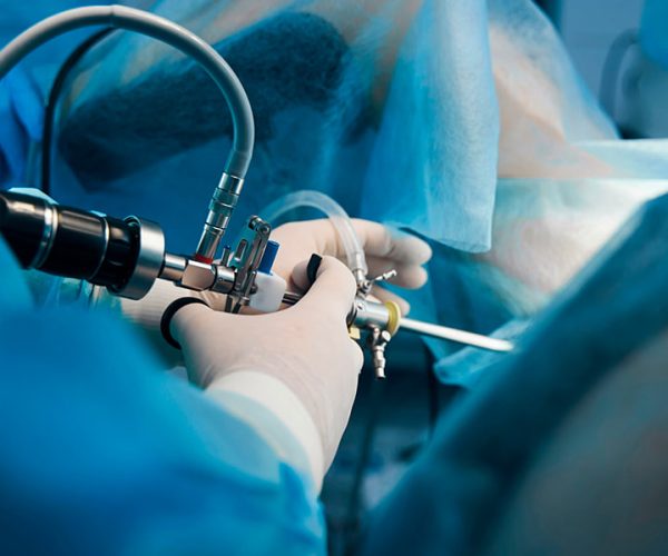 Hysteroscopy Hysteroscopy