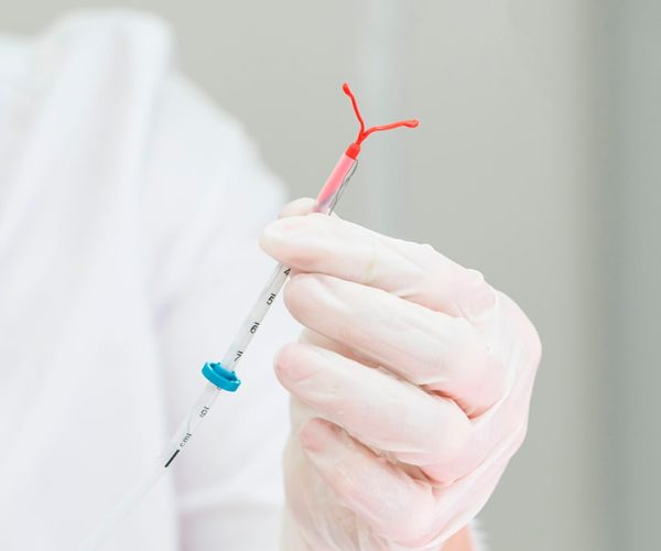 IUD Insertion and Removal IUD-Insertion-and-Removal