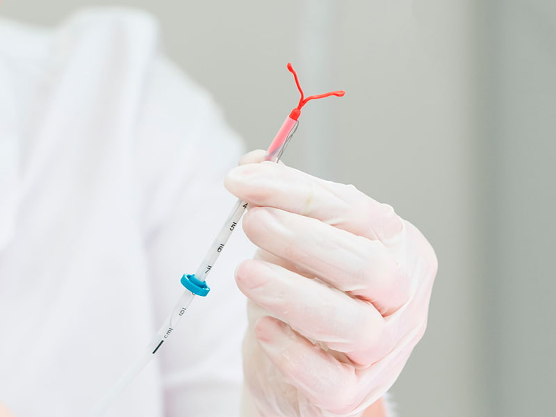 Iud-insertion-and-removal