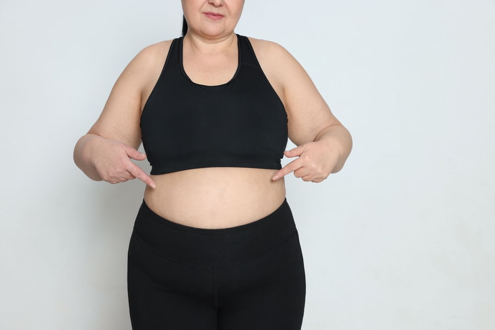 Challenges after bariatric surgery 1 Bariatric surgery