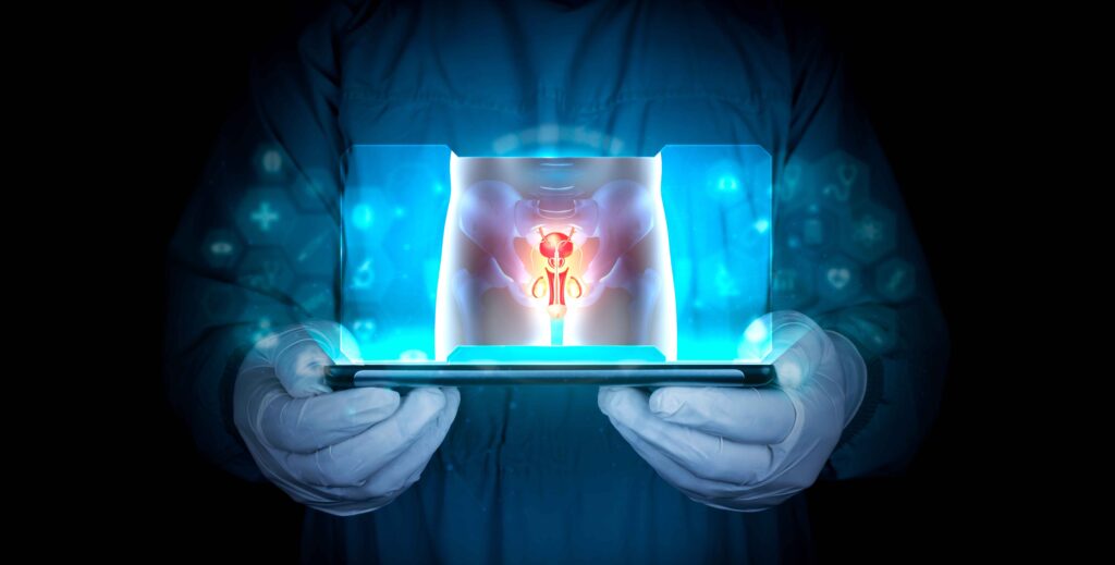 Peyronieocos disease