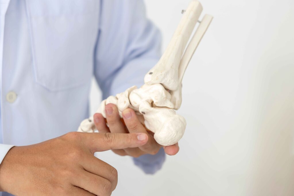 Plantar fasciitis surgery 5 Plantar fasciitis surgery