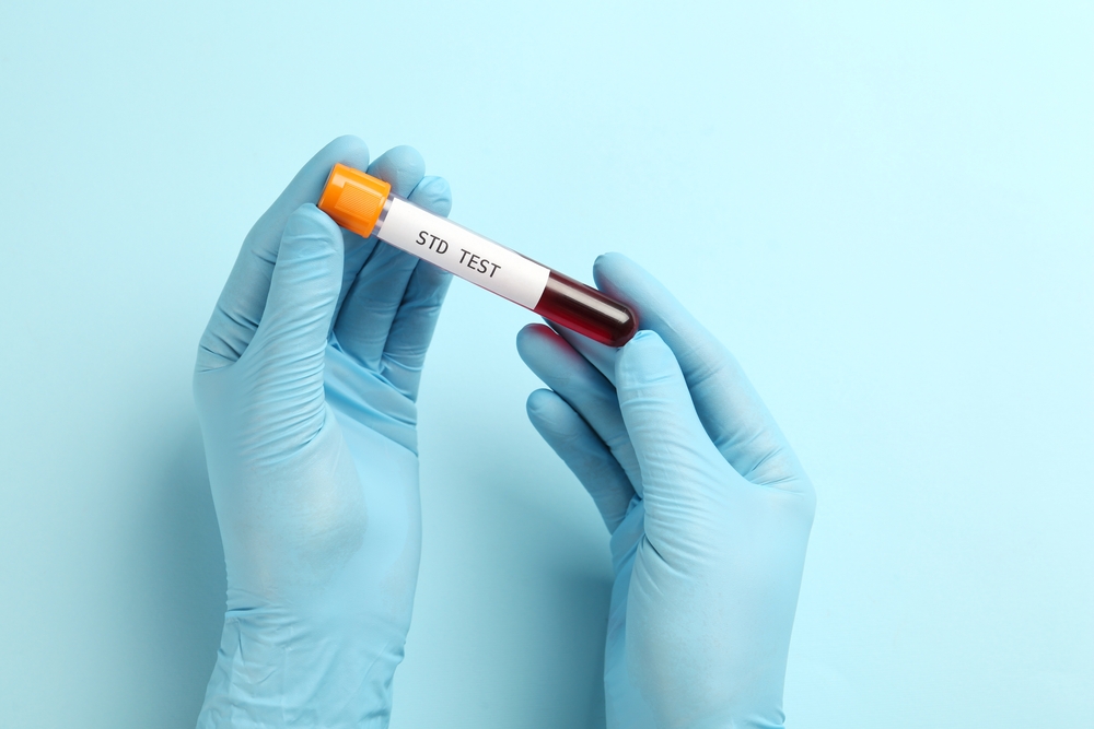 rapid std testing