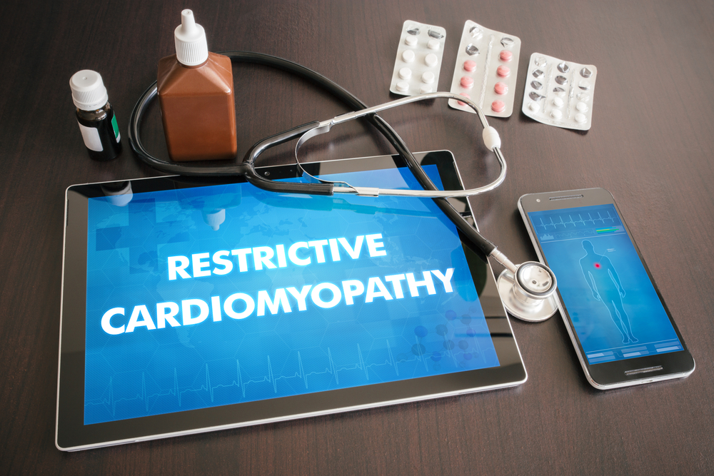 restrictive cardiomyopathy