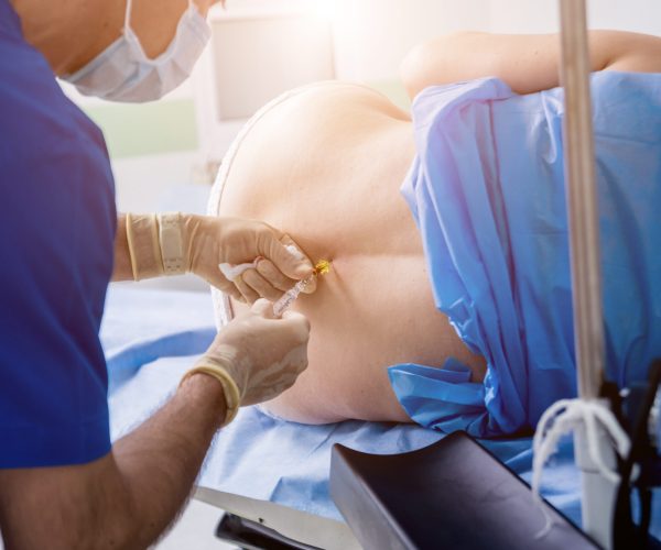 Epidural Injections Epidural Injections