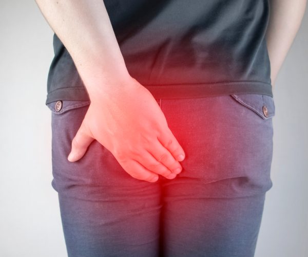 Anorectal Manometry Anorectal Manometry