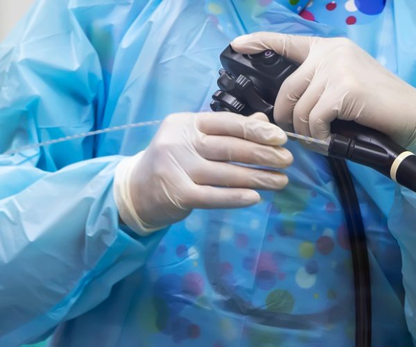 Endoscopic Retrograde Cholangiopancreatography (ERCP) Endoscopic Retrograde Cholangiopancreatography (ERCP)