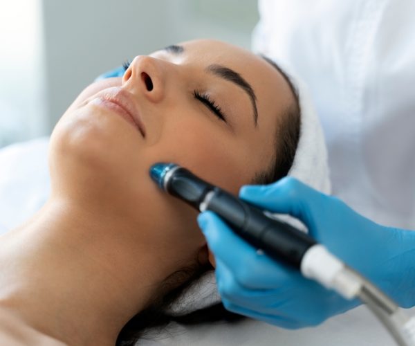 Microdermabrasion
