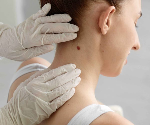 A diagnostic procedure to collect a small skin sample for laboratory analysis. Skin Biopsy