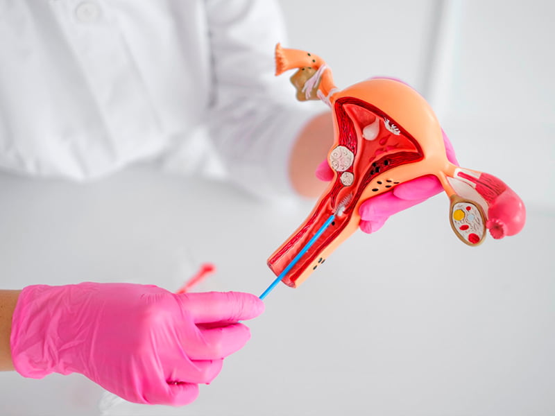 Uterine-biopsy