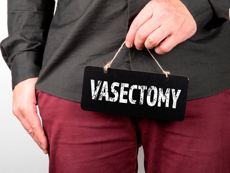Vasectomy