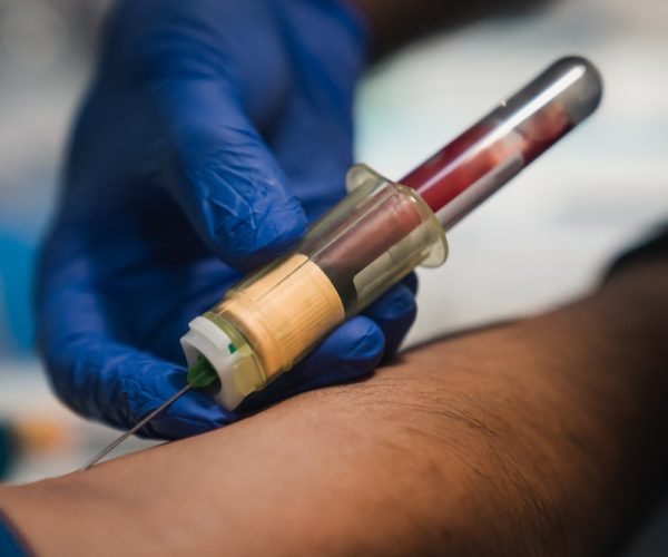 Routine Venipuncture Routine Venipuncture