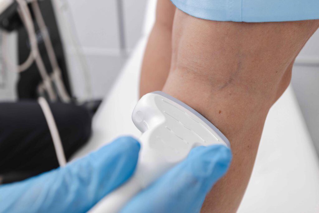 Venous/vascular ultrasound (lower extremity) 3 Venous/vascular ultrasound (lower extremity)