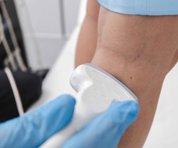 Venous/Vascular Ultrasound (Lower Extremity) Venous/Vascular Ultrasound (Lower Extremity)